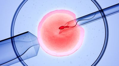 Bị u xơ tử cung có làm ivf được không? Xem ngay đáp án TẠI ĐÂY!